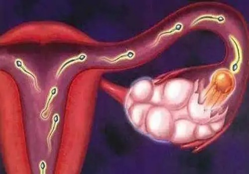深圳试管助孕价格：卵巢脓肿手术后能恢复之前状态，一定要休息好